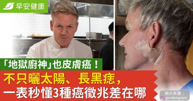 「地獄廚神」也皮膚癌！不只曬太陽、長黑痣，一表秒懂3種癌徵兆差在哪