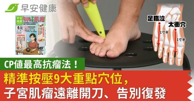 CP值最高抗瘤法！精準按壓9大重點穴位，子宮肌瘤遠離開刀、告別復發