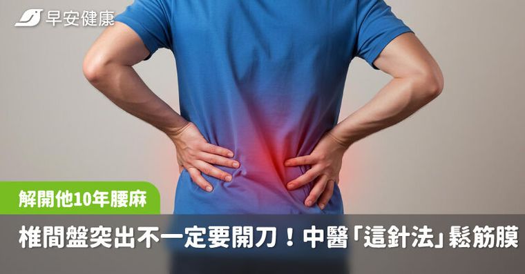 椎間盤突出不一定要開刀！中醫「這針法」鬆筋膜、調脊椎，解他10年腰麻腳痛