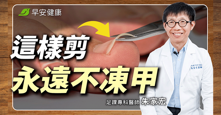 甲溝炎又痛又腫竟因「指甲剪錯」！醫教正確剪指甲2訣竅自救免拔甲